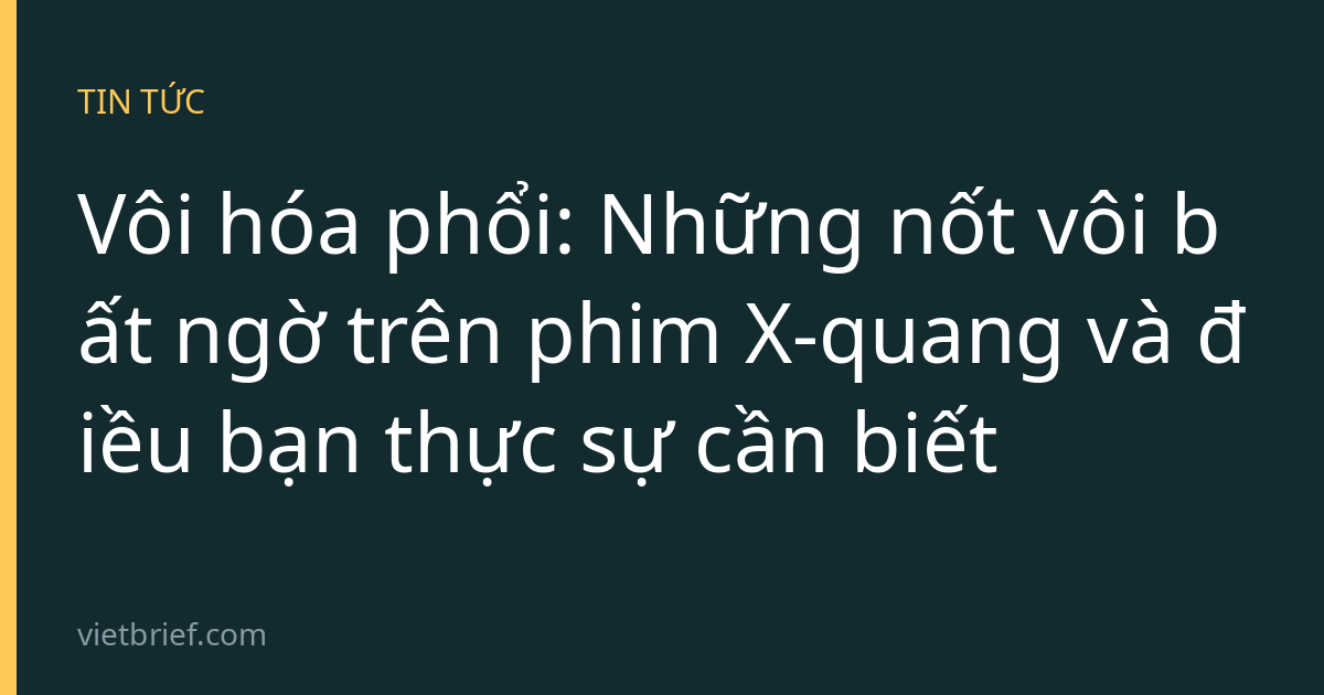 Vôi hóa phổi: Những nốt vôi bất ngờ trên phim X-quang và điều bạn thực sự cần biết