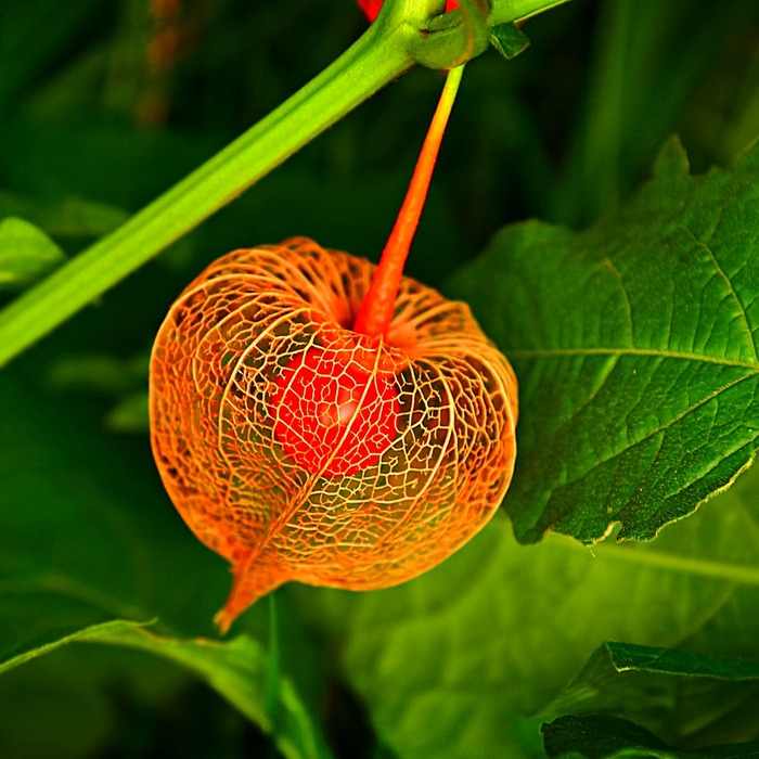 Sỏi thận viêm bàng quang